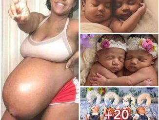 “After being childless for 17 years, a Nigerian woman Finally gave birth to three bouncing baby boys Today in Lagos.”(Photos)